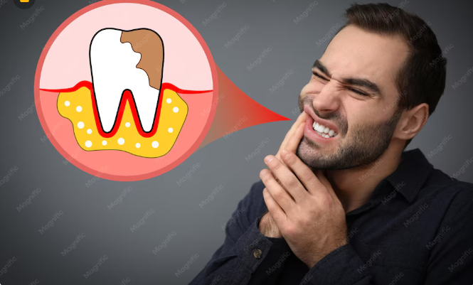 3 Warning Signs Of Gum Disease To Watch For Gum Disease To Watch For